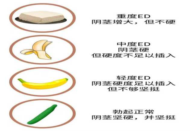 揭秘现代阳痿治疗新突破：前沿疗法引领男性健康回归之道